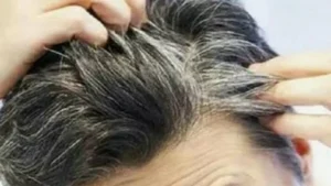 طريقة ايقاف تساقط الشعر عند الرجال
