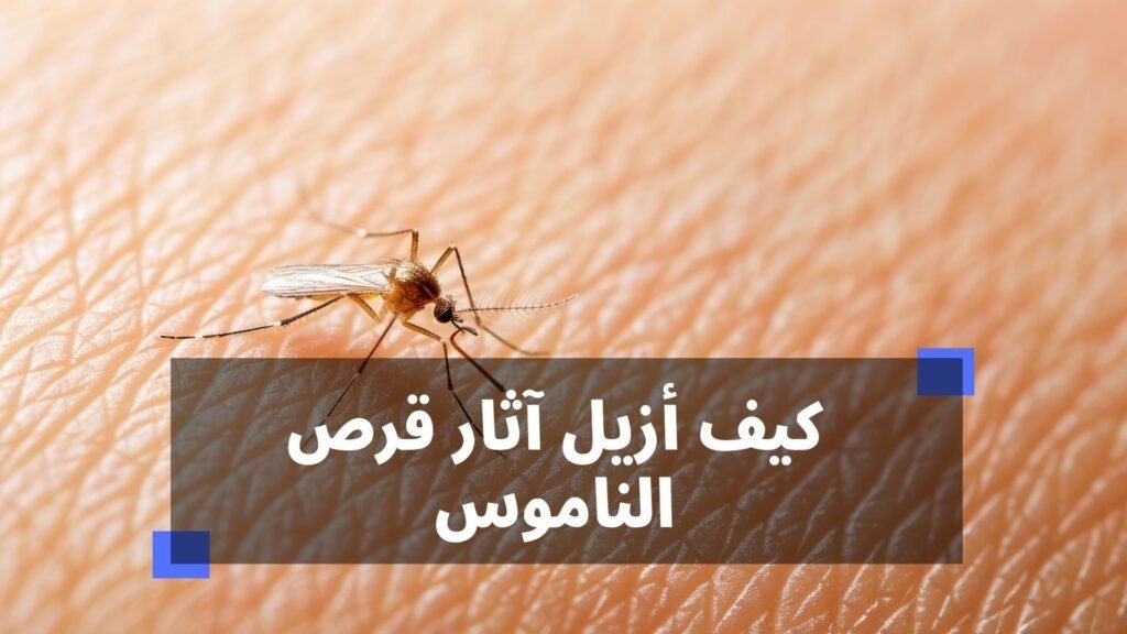 كيف ازيل اثار قرص الناموس