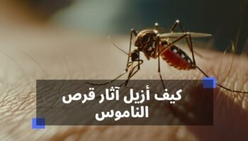 كيف ازيل اثار قرص الناموس
