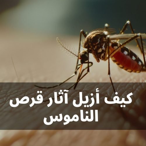 كيف ازيل اثار قرص الناموس وتخفف الحكة بسرعة